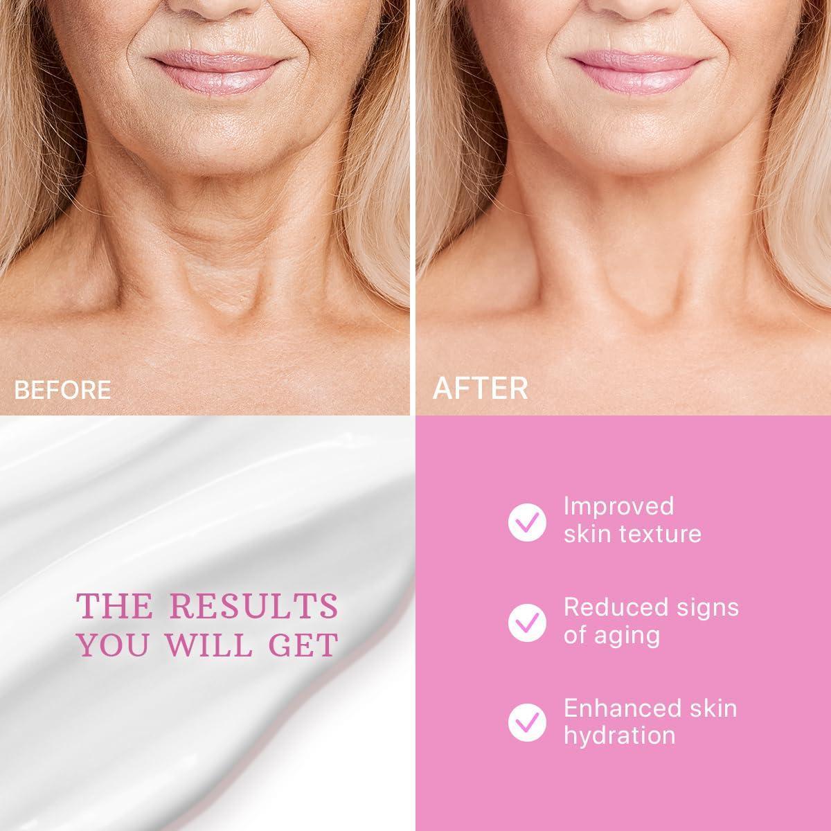 Neck Firming Cream Tightening Lifting Sagging Skin with Retinol & Collagen